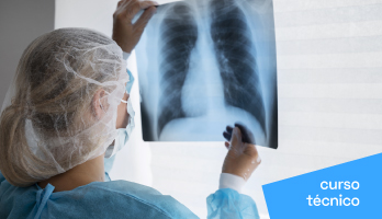 Curso Técnico em Radiologia: saiba tudo sobre a profissão Curso Técnico em Radiologia: saiba tudo sobre a profissão